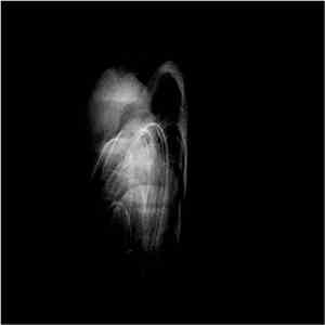 Coppice Halifax - Malsekeco download free