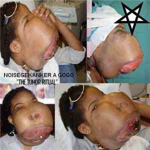 Noisegekanker A Gogo - The Tumor Ritual download free